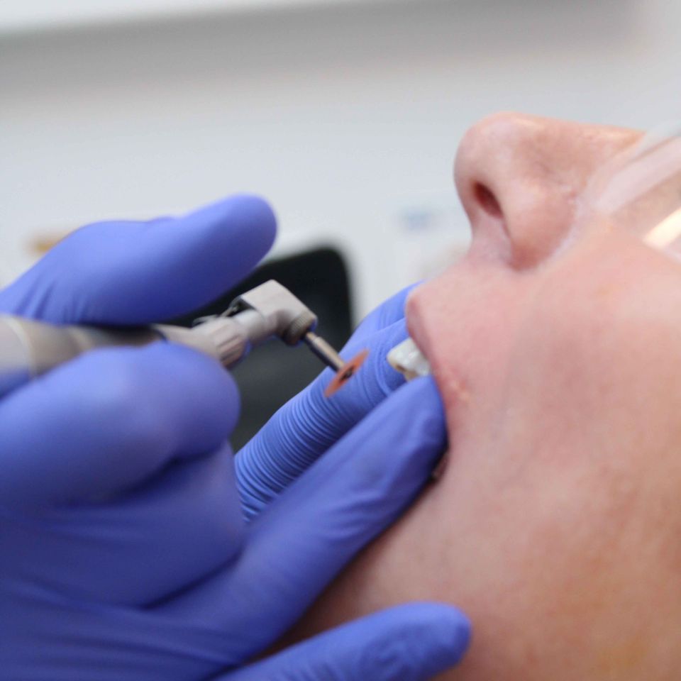 Dentist in blue latex gloves using a rotary dental tool inside a patient's open mouth